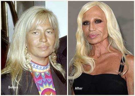 why is versace so ugly|See Donatella Versace's Shocking Transformation .